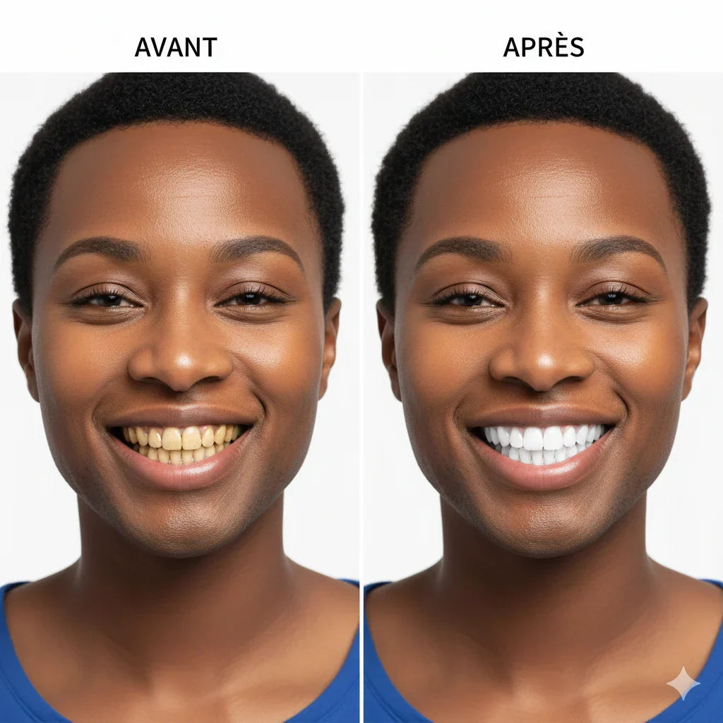 Sérum Correcteur de Couleur V34 Glorysmile – Dentifrice Violet Blanchissant & Menthe Fraîche