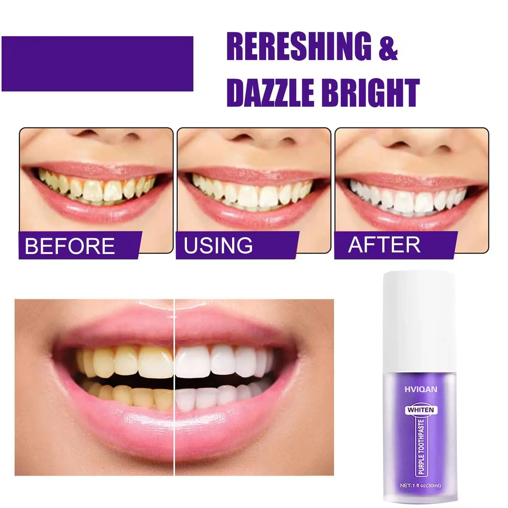 Sérum Correcteur de Couleur V34 Glorysmile – Dentifrice Violet Blanchissant & Menthe Fraîche