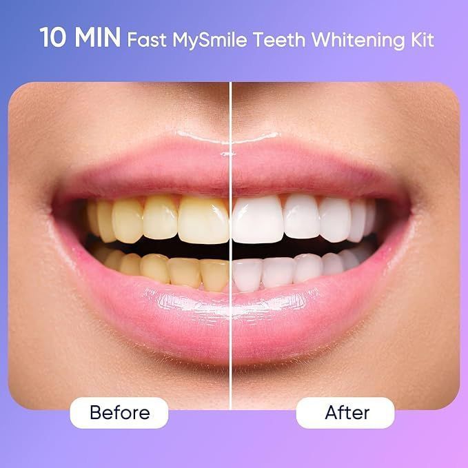 Sérum Correcteur de Couleur V34 Glorysmile – Dentifrice Violet Blanchissant & Menthe Fraîche